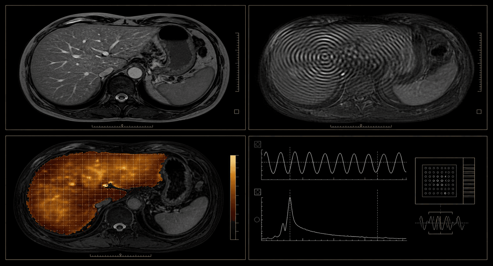 Illustrative liver MRI and MRE data workstation