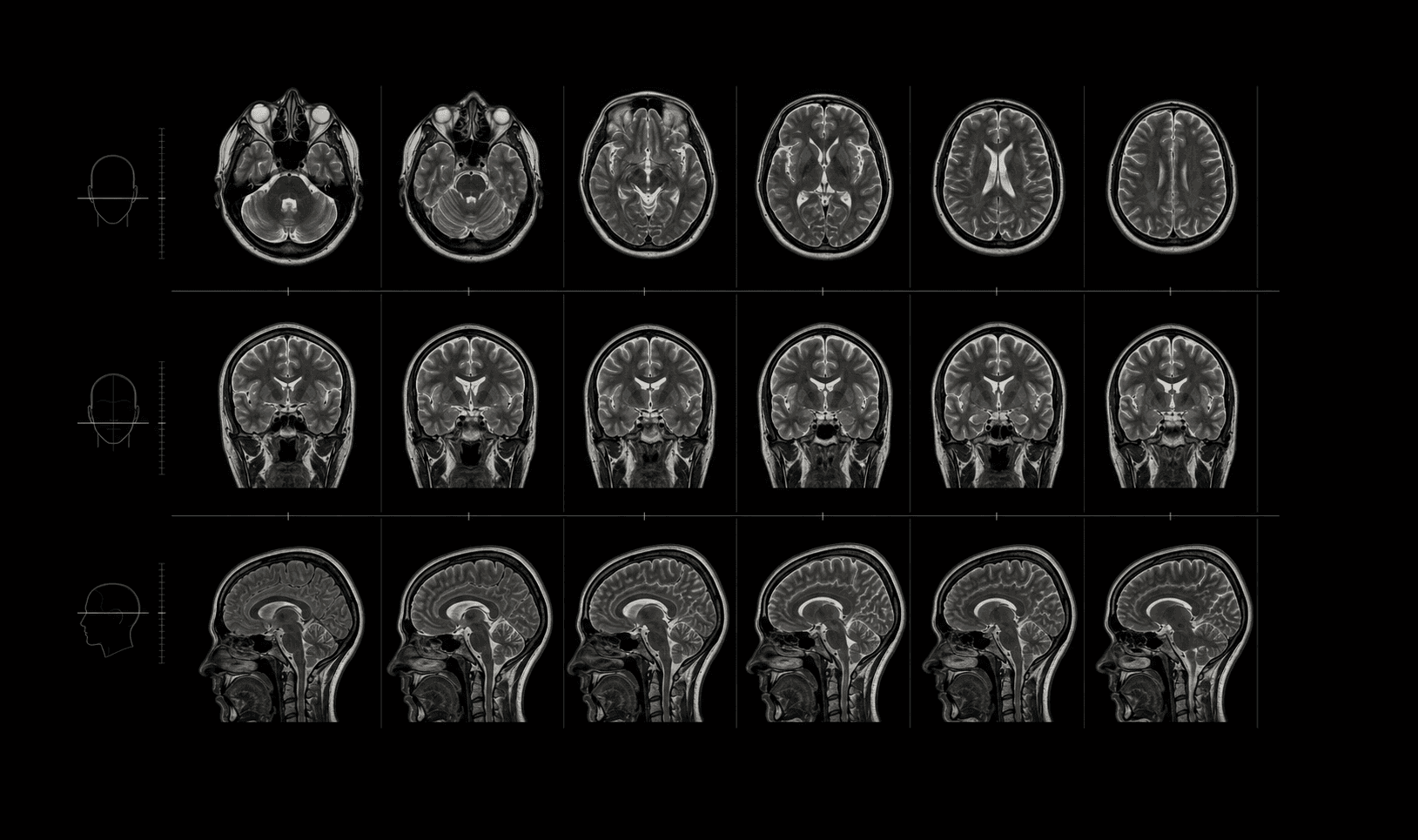 Illustrative multi-planar brain MRI data atlas